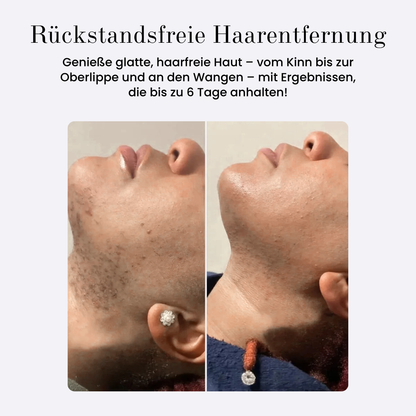 Rosely Sanft & Glatt Duo (Gesichtshaarcreme + GRATIS Serum)